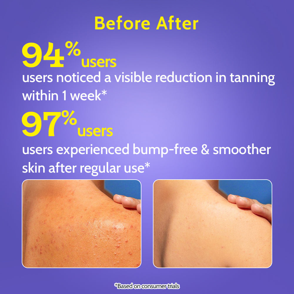 4% Exfoliating Body Wash with Lactic Acid & Salicylic Acid - 236 ml