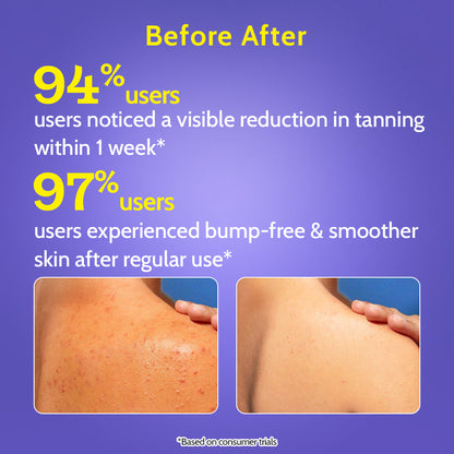 4% Exfoliating Body Wash with Lactic Acid & Salicylic Acid - 236 ml