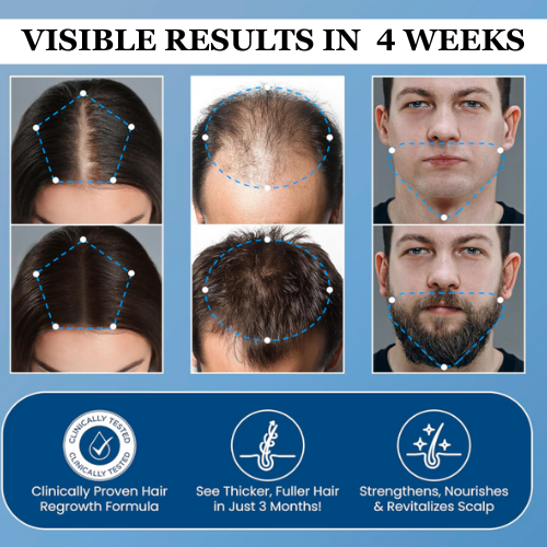 Aparthy Hair Growth Serum
