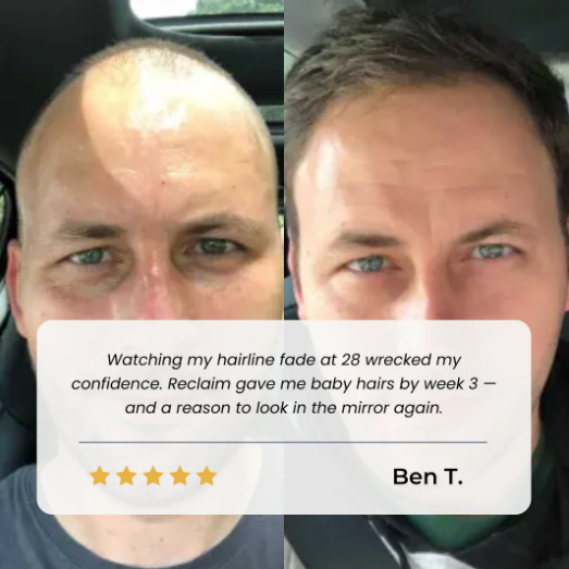 Aparthy Hair Growth Serum